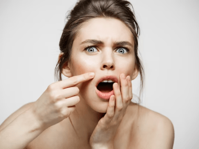 Tratamentos Profissionais para Pele Oleosa: Opções Eficazes para um Rosto&nbsp;Radiante